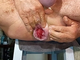 扩肛侠2025-14 hot story gay porn