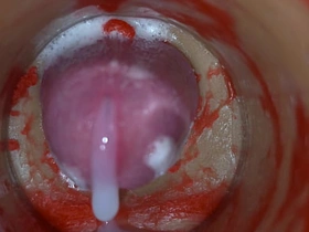 内射实录——体内镜头捕捉男性深喉射精 gay porn japan alfresco